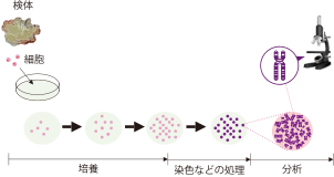 羊水染色体分析