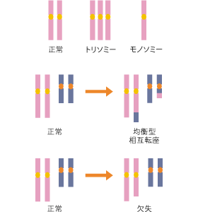 染色体異常とは