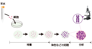 羊水染色体分析